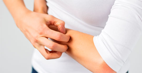 prevenir las picaduras de mosquitos